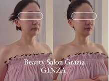 グラツィア 銀座(Grazia)/小顔フェイシャル【ブライダル】