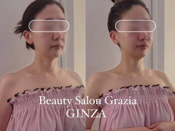 グラツィア 銀座(Grazia)/小顔フェイシャル【ブライダル】