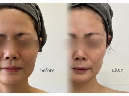 エイトビューティデザイン(eight beauty design)の写真