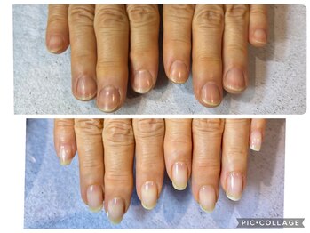 アンドネイル 海老名(&nail)/自爪育成ジェル Before After