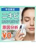 平日9-15時限定★￥0【繰り返すニキビ肌質改善】肌診断×分析カウンセリング☆
