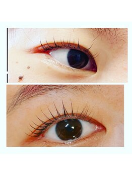 ムーナボーテ(Moona Beaute)/美容液の凄さ