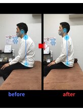 骨盤矯正西区堀江整体院/姿勢改善