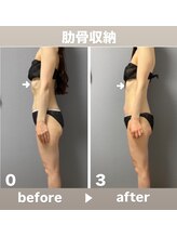 メゾン ド クロエ(Maison de Chloe)/CHLOE式パーソナル痩身