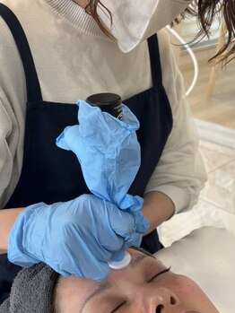 ティンクルホワイト 橿原店の写真/本気の肌質改善を目指すならプロセルセラピーズ！肌のお悩みお聞かせください♪ハリツヤのある滑らか肌に◎