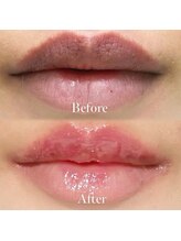 ルナベル(Luna Bell)/ルメラ：唇