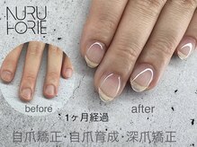 ヌル ネイル 堀江(NURU NAIL HORIE)/自爪矯正・自爪育成・深爪矯正☆