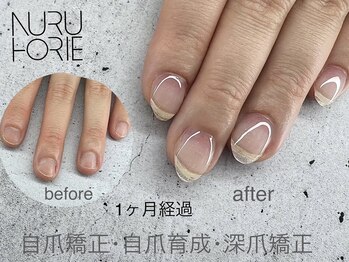 ヌル ネイル 堀江(NURU NAIL HORIE)/自爪矯正・自爪育成・深爪矯正☆