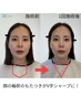 【極上肌管理水素フェイシャル】本気で小顔！毛穴・たるみ・くすみ・しわ