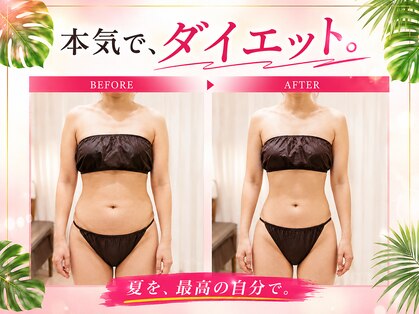 上野エステサロン レア(Lea)の写真
