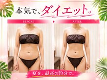 上野エステサロン レア(Lea)