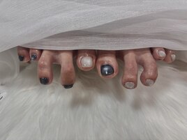フットネイル