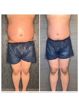 マハロ ザ ビューティー(mahalo the beauty)/痩身