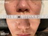 ■肌管理ご希望の方≪迷ったらコチラの枠で予約≫カウンセリング+当日施術OK