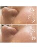 ハイドラ毛穴洗浄＋肌質別クレイパック ¥5,500