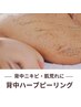 【人気No.4】背中美人♪背中のハーブピーリング（ざらつき・黒ずみ）