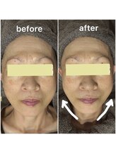 ユフラ(Yufla)/水素導入1回での結果