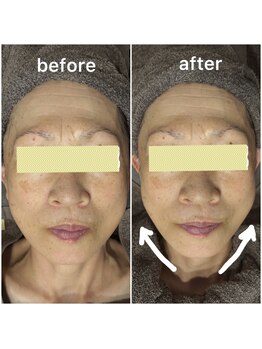 ユフラ(Yufla)/水素導入1回での結果