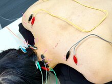 とだ鍼灸院/《鍼灸施術》首肩レスキュー鍼灸