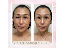 プロのアプローチで改善ステップを踏みながら、効果実感！