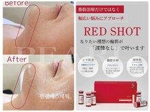 脂肪分解レッドショット！二重あごスッキリラインへ☆眼底脂肪に