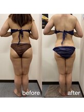 キアラ(chiara)/ 30代３ヶ月後