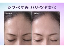 フルールドリス(FLEUR DE LIS)