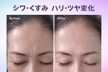 フルールドリス(FLEUR DE LIS)