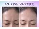 フルールドリス(FLEUR DE LIS)の写真