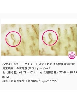 フルール エンビロン(フルール ENVIRON)/血流が改善されている。