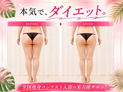 上野エステサロン レア(Lea)の写真