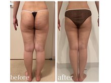 美人バスト 静岡店/足症例