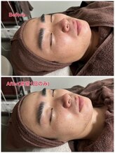 スーパースカルプ 大津店(SuperScalp)/お客様before/after写真