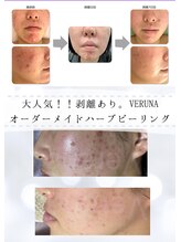 ユアーズ ビューティー(YOURS beauty) お肌悩み 徹底改善