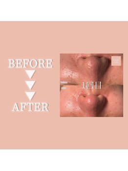 クリアラボ 日本橋(Clear Lab)/Before＆After