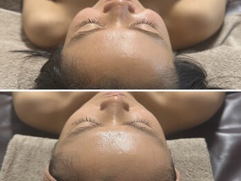 ヌー(gnu)/ちゅるりん美肌フェイシャルWAX