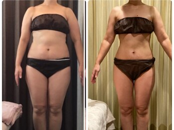 ウェリナ平和堂長久手院/.【ダイエットbefore→after】