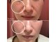 ベルタ(BELTA)の写真