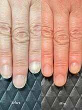 クーラ アンド ベリッシモ(Cura&Bellissimo)/