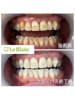 ルブラン 奈良店(Le Blanc)/笑顔に自信を持ちたい方へ