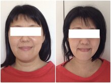 ウェリナ平和堂長久手院/小顔矯正/骨盤矯正/美脚サロン