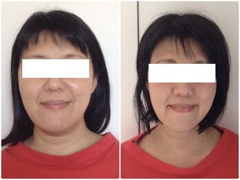 ウェリナ平和堂長久手院/小顔矯正/骨盤矯正/美脚サロン