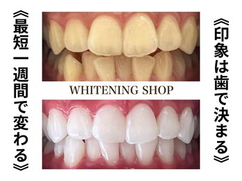 ホワイトニングショップ 今出川店(WHITENING SHOP)