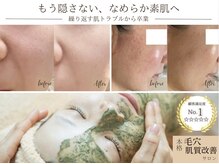 ソワンドビジュー(soin de bijew)