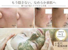 ソワンドビジュー(soin de bijew)
