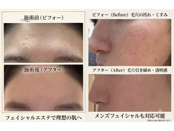サロンベル(Salon Belle)の写真/自社製品でくすみやハリを整える本気の施術を体験!弾力と美白を目指すケアを◎