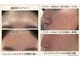 サロンベル(Salon Belle)の写真/自社製品でくすみやハリを整える本気の施術を体験!弾力と美白を目指すケアを◎
