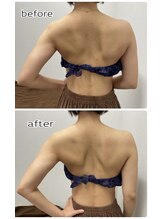 エンチャント(ENCHANT)/腕、肩甲骨、肩こり、スッキリ☆