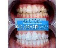 ライトケアサロン 表参道店(Light Care Salon)/施術実績多数♪ホワイトニング店