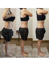 しあわせ腸研究所/腸もみbefore & after